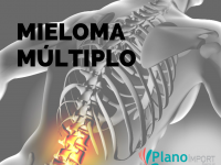 Mieloma Múltiplo