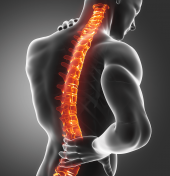 Mieloma múltiplo tem sintomas silenciosos e exige atenção