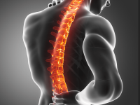 Mieloma múltiplo tem sintomas silenciosos e exige atenção